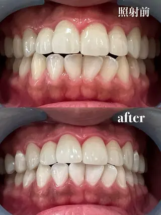 𝐑𝐞𝐯𝐢𝐨 ___堺市西区のマツエク・マツパデザイン