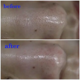 ANRIRE (アンリール)のエステ・リラクイメージ