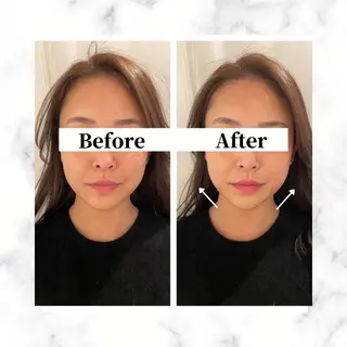 12Dハイフ💗 最強小顔のエステ・リラクイメージ