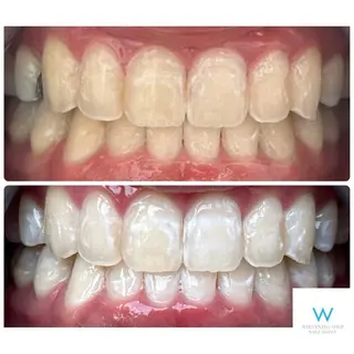 ホワイトニングショップ奈良生駒店所属・乾 理望のエステ・リラクイメージ