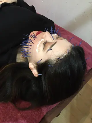 美容鍼灸女性専用 りんご鍼灸治療院のエステ・リラクイメージ