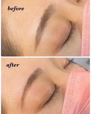 アイブロウ ハーブピーリング/韓国肌管理/フェイシャル/毛穴洗浄/眉毛/顔脱毛【糸脱毛専門】rev所属・ハーブピーリング🌹 毛穴洗浄❤️眉waxのエステ・リラクイメージ