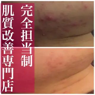 ミディアム カラー パーマ ヘアアレンジ メンズ キッズ ネイル マツエク・マツパ アイブロウ ニキビ・肌質改善専門 ♡人生が変わるサロンのエステ・リラクイメージ