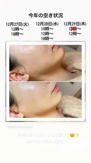 La beauté et santé岡崎店所属・望月 はるかのエステ・リラクイメージ