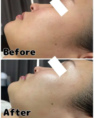 ROR Akariのエステ・リラクイメージ