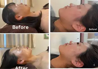 NICORI　小顔&肌質改善専門店所属・小顔＆肌質改善 NICORIのエステ・リラクイメージ