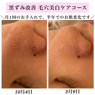 Bellesthe （ベルエステ）のエステ・リラクイメージ