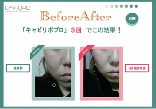 エステサロン JURISのエステ・リラクイメージ