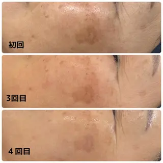 Mia.rosa所属・光フェイシャル・脱毛 MIA.ROSAの眉毛・アイブロウイメージ