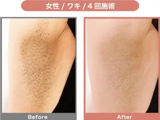 脱毛&フェイシャル 専門店muro.のエステ・リラクイメージ