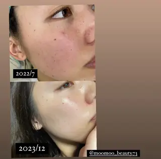 岸和田／久米田 MooMooのエステ・リラクイメージ