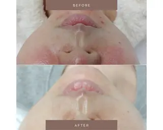 Salon💫 Lino'a柏店のエステ・リラクイメージ