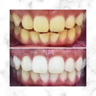 LBSホワイトニング 🌐渋谷店スタッフのエステ・リラクイメージ