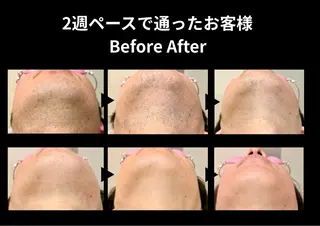 メンズ 脱毛サロン&ドライヘッドスパFIS 溝の口店所属・脱毛サロン FIS　溝の口店のエステ・リラクイメージ