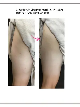 美筋骨格リンパ®️ Aroleのエステ・リラクイメージ