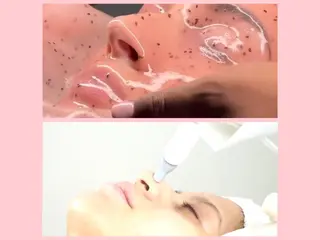 SHINY エステサロンのその他イメージ