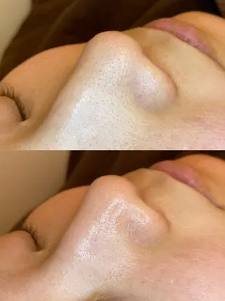 EARTH coiffure beaute 新潟紫竹山店所属・🤍アベシュリ /フェイシャル🤍のエステ・リラクイメージ