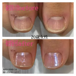 ネイル 自爪育成専門サロン エムロードゥ池下のネイルデザイン