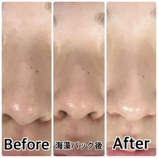 林 陽向のエステ・リラクイメージ