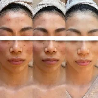 Lapis maikaのエステ・リラクイメージ