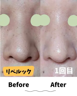 コンセプトサロン友 木下のエステ・リラクイメージ