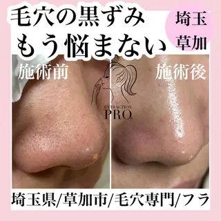 毛穴専門店hula 杉山智美のエステ・リラクイメージ