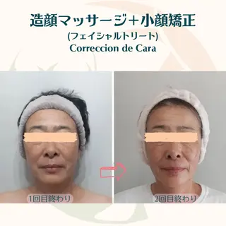 小顔矯正☀︎バスト ☀︎ハルのエステ・リラクイメージ