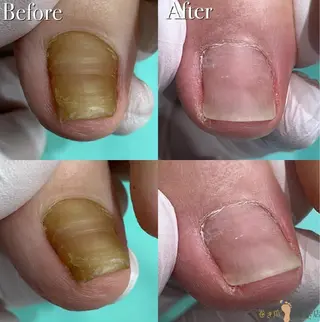 福岡巻き爪補正店 博多店のエステ・リラクイメージ