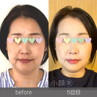 小顔矯正サロン町田 逸見智美のエステ・リラクイメージ