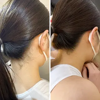 うなじ脱毛/美肌脱毛 LABELのエステ・リラクイメージ