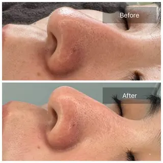 トータルしみケア専門 NICA(ニカ)のエステ・リラクイメージ