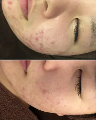 ミディアム カラー パーマ ヘアアレンジ メンズ キッズ ネイル マツエク・マツパ ニキビ・肌質改善専門 ♡人生が変わるサロンのエステ・リラクイメージ