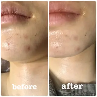 Cocofran/ manatsuのエステ・リラクイメージ