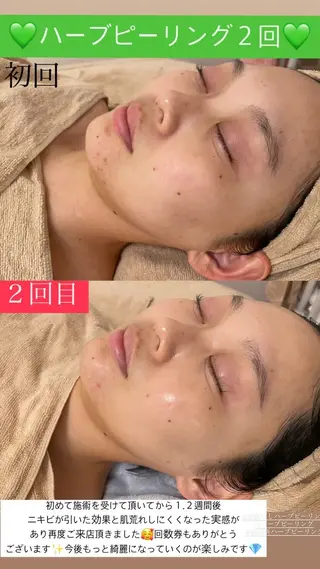 メンズ Salon de Lino 御器所のエステ・リラクイメージ