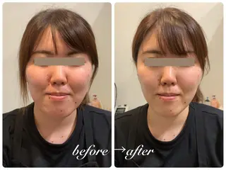 痩身脱毛専門店 Partirのエステ・リラクイメージ