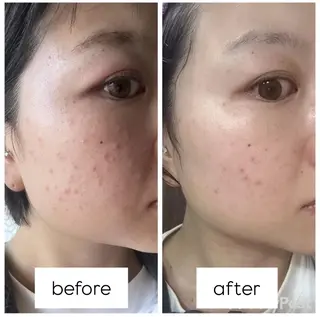 毛穴シミケアサロン Beau　堀口まひろのエステ・リラクイメージ