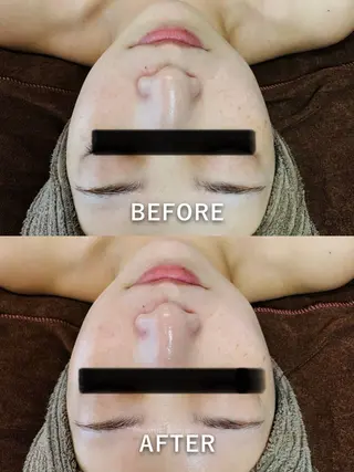 LukeBeauty salonのエステ・リラクイメージ