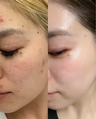 Liber Kyoto所属・魔法の シミ取り職人のエステ・リラクイメージ