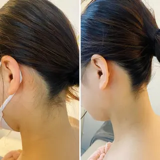 うなじ脱毛/美肌脱毛 LABELのエステ・リラクイメージ