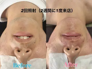 メンズ トータルビューティー サロン Lisseの眉毛・アイブロウイメージ