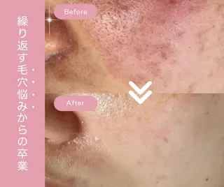 毛穴ケア専門サロン miliのエステ・リラクイメージ