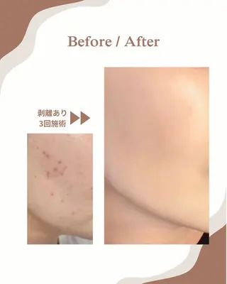 myherb所属・ニキビ肌改善サロン myherb🌿のエステ・リラクイメージ