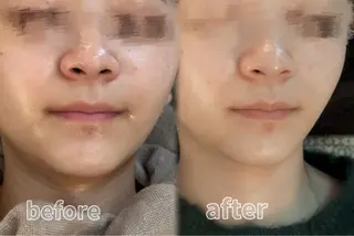 🌱浮腫|こり|張り 日々の疲れを解消⭐️のエステ・リラクイメージ