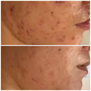 触れたくなる モテ肌へ...❤︎のエステ・リラクイメージ