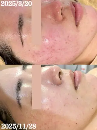 WHITE AQUA 北千住店のエステ・リラクイメージ