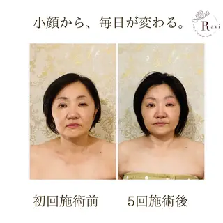 小顔サロンラヴィ　　船橋馬込沢店所属・小顔サロンラヴィ 船橋のエステ・リラクイメージ