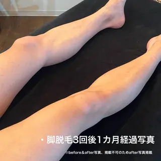 メンズ TEDDY BASE 眉＆脱毛サロンのエステ・リラクイメージ