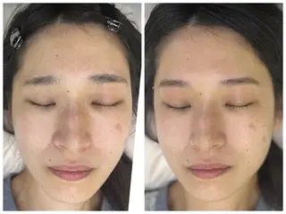 アイブロウ アイブロウサロンMily所属・眉毛/美肌の専門店 Mily🍒ミウィの眉毛・アイブロウイメージ