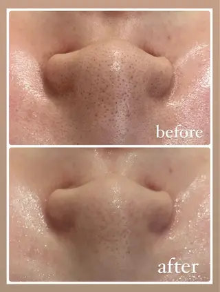 RAY Beauty エステ　一宮店のエステ・リラクイメージ