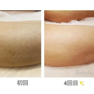 メンズ Relight あかりのエステ・リラクイメージ